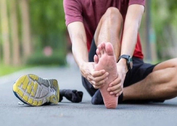 Plantar Fasciitis